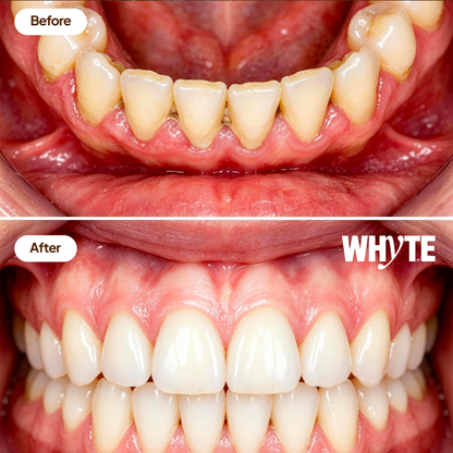 Cinnamon Oil Pulling Rinse