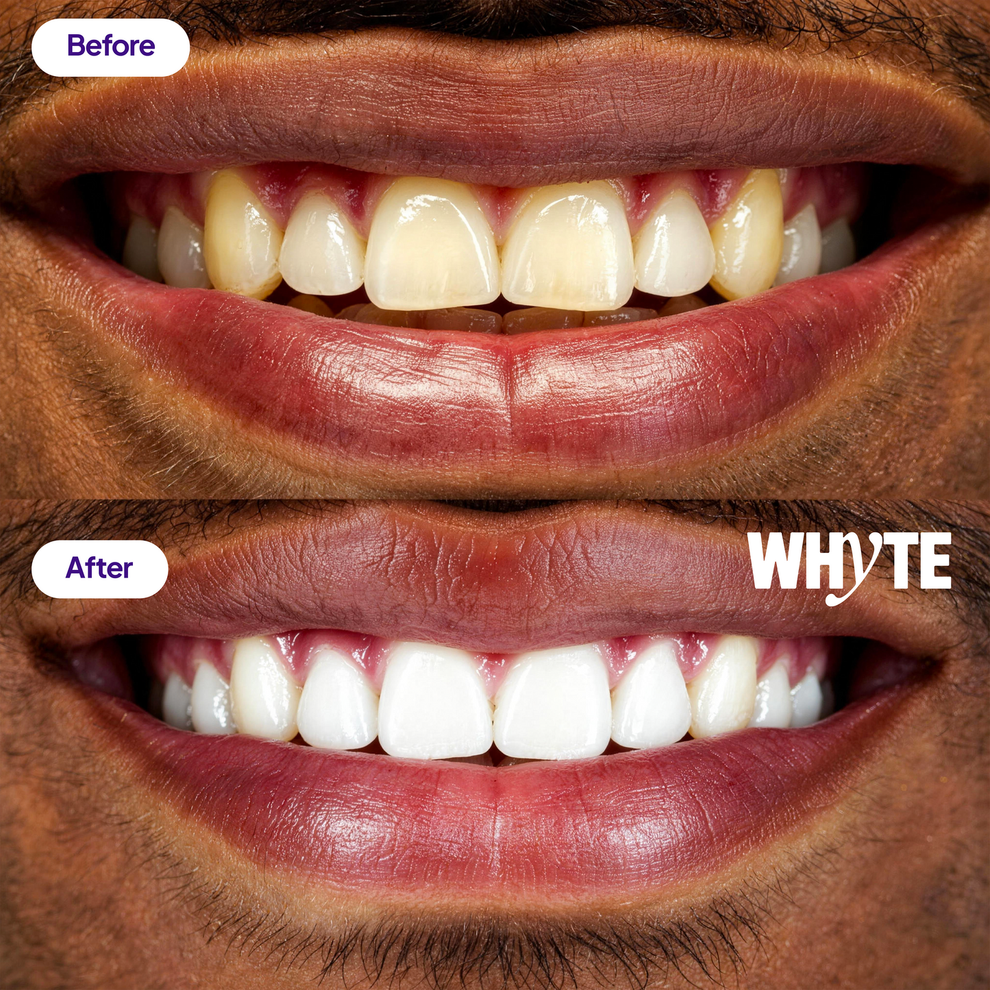 Purple Teeth Whitening Powder