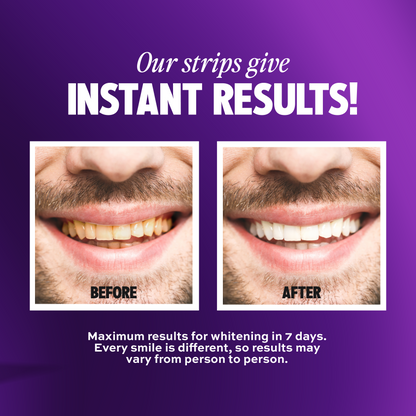 Purple Whitening Strips